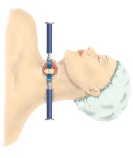 Cervical artificial disc replacement surgery