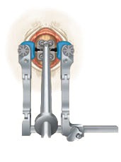 Cervical artificial disc