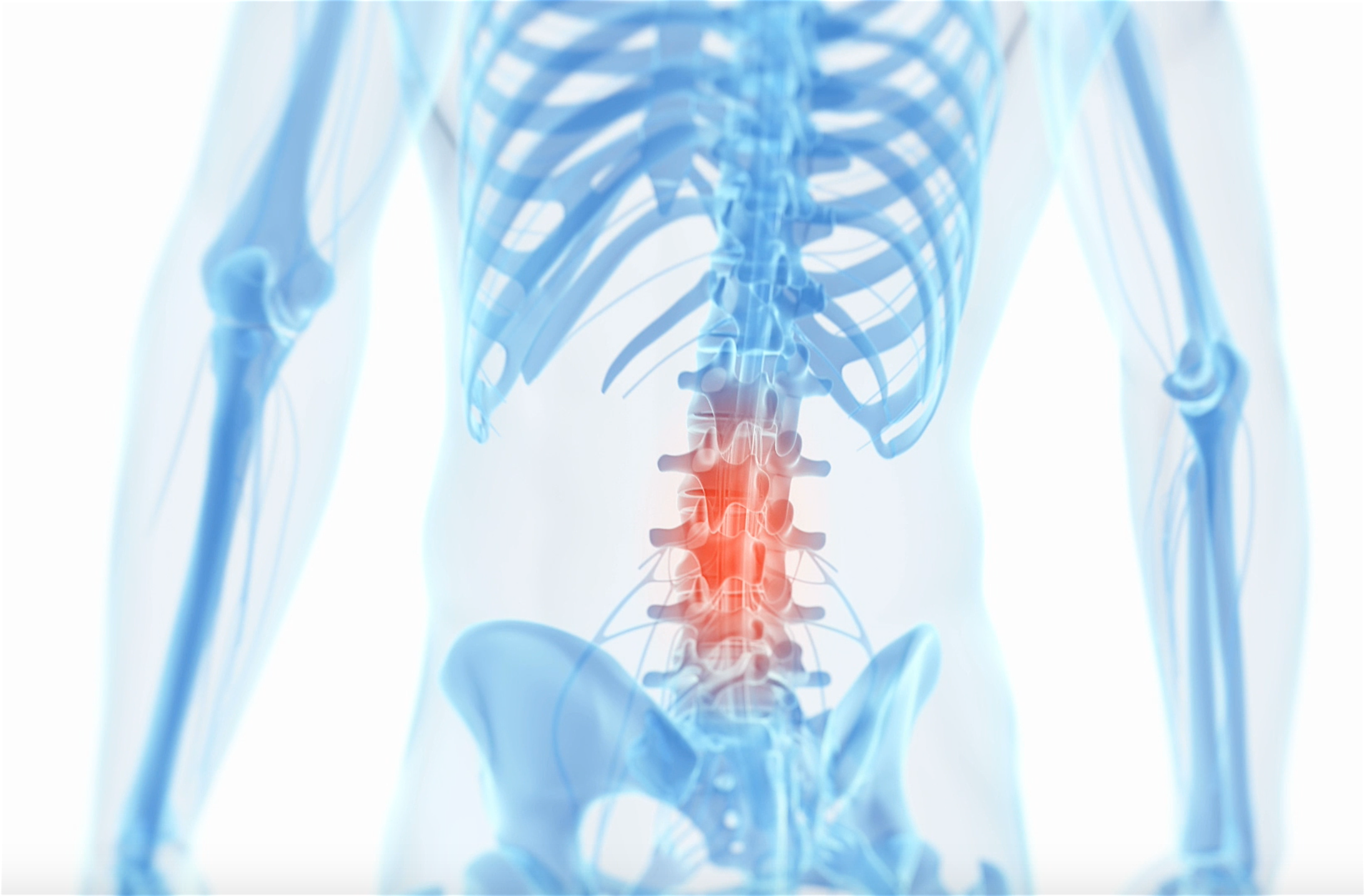 lower back pain illustration K. Rad Payman, MD